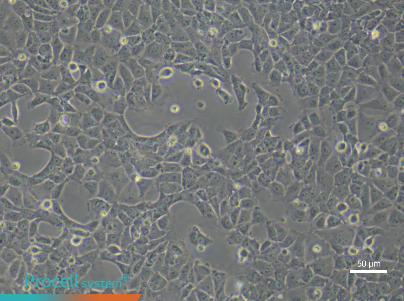 Rat Cardiac Fibroblast (Primary cell immortalization) Complete MediumRat Cardiac Fibroblast (Primary cell immortalization) Complete Medium - 6