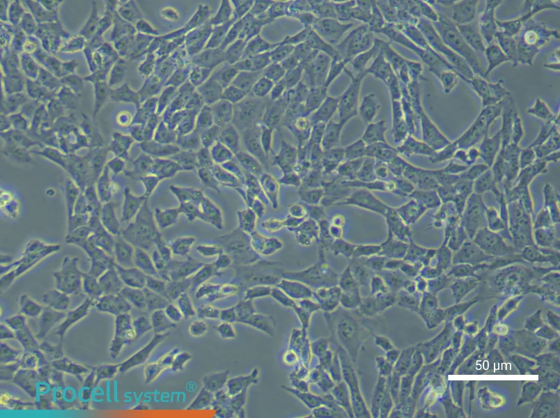Mouse Pulmonary Artery Endothelial Cells (Primary cell immortalization)Mouse Pulmonary Artery Endothelial Cells (Primary cell immortalization) - 6