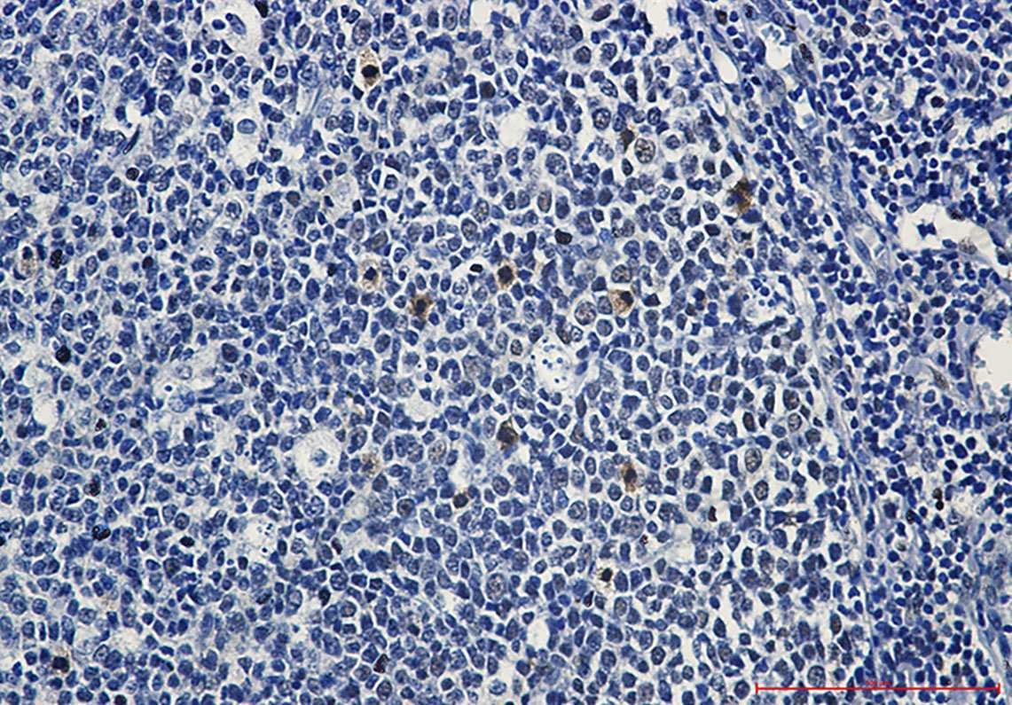 Recombinant Phospho-c Myb (Ser11) Monoclonal Antibody - 2