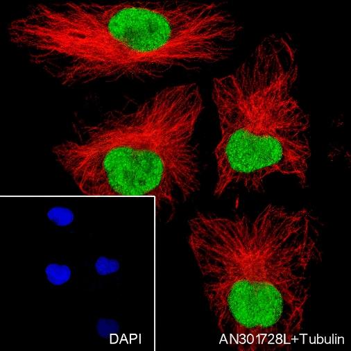Recombinant DNMT1 Monoclonal Antibody - small - 4
