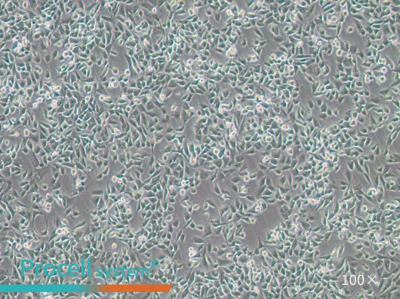 CHP-212 Cell Complete Medium - 1