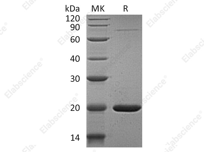 Recombinant Human GABARAPL1 Protein (His Tag) - 1