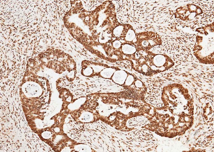CCNE1/Cyclin-E1 Monoclonal Antibody - small - 3