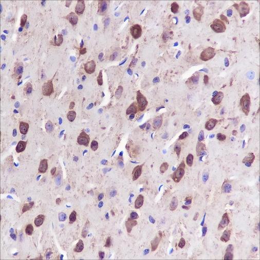 Recombinant ST13 Monoclonal Antibody - 2