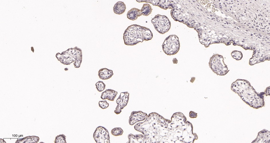 Recombinant CD105 Monoclonal Antibody - small - 2