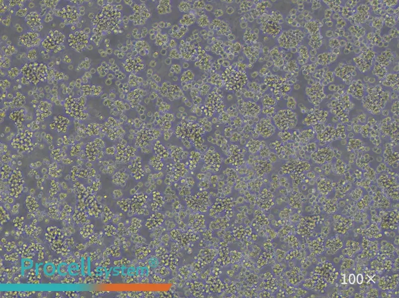 Jurkat, Clone E6-1 Cell Complete Medium - 2