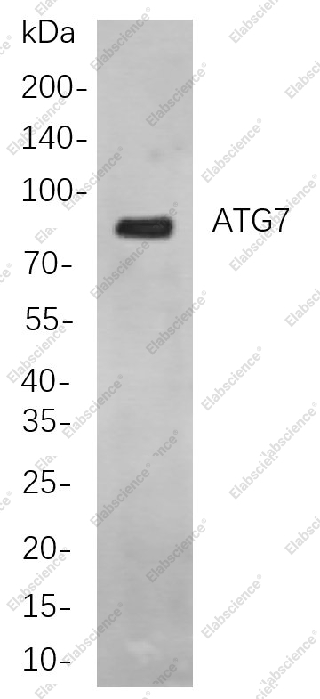 Recombinant ATG7 Monoclonal Antibody - 1