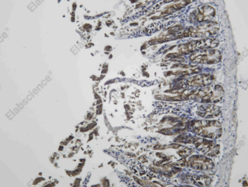 Recombinant IGF2-BP2 Monoclonal Antibody - 2