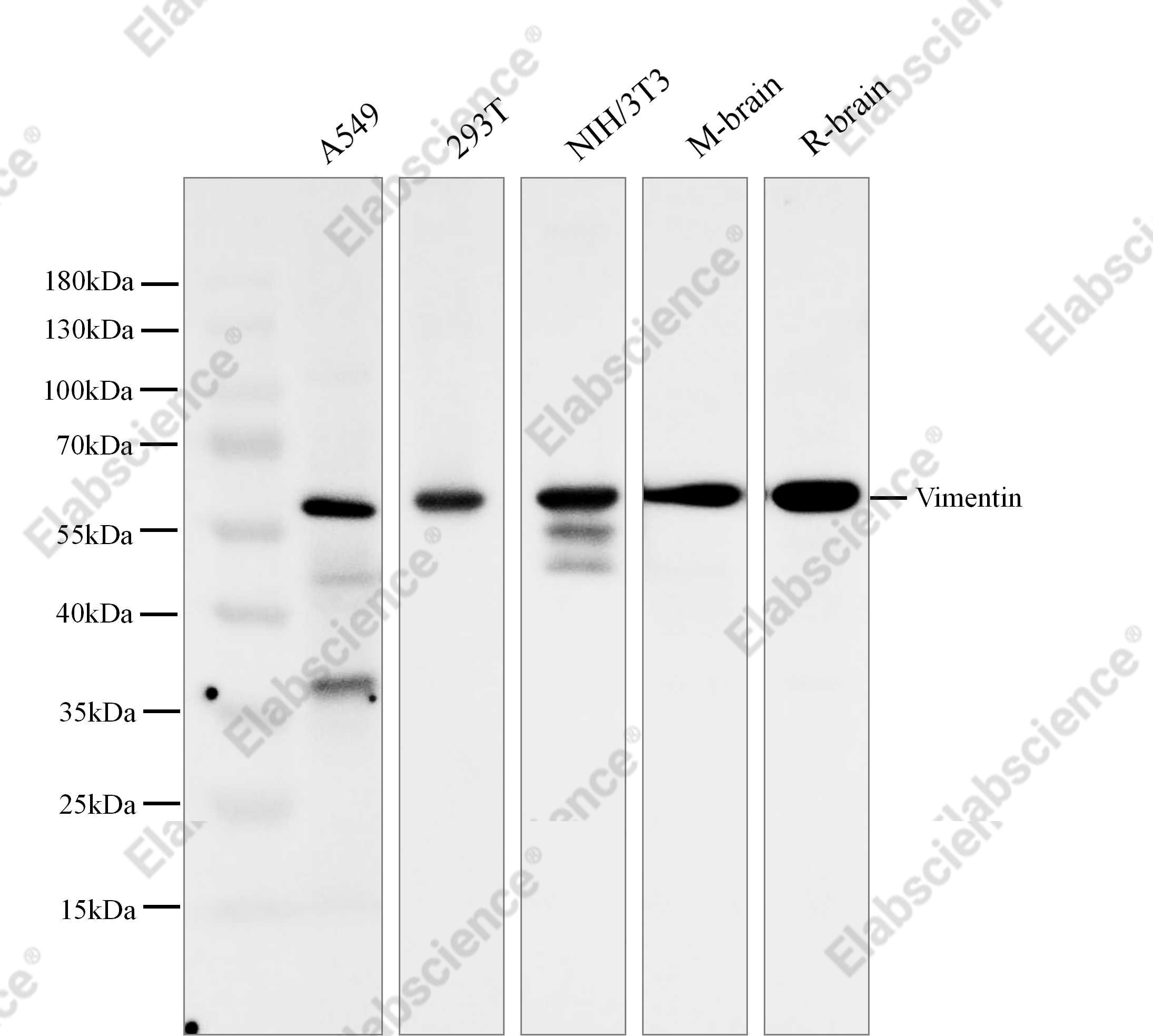 Recombinant Vimentin Monoclonal Antibody - 1