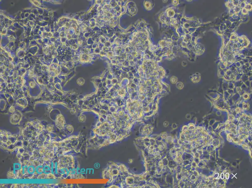 KM12 Cell Complete Medium - 4