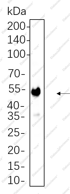 Recombinant CaMKII α Monoclonal Antibody - 1