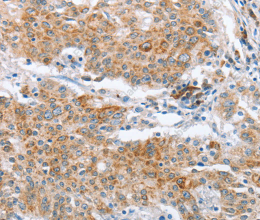 CRELD2 Polyclonal Antibody - 3