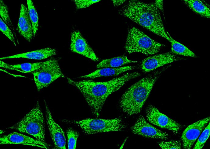 Recombinant P4HB Monoclonal Antibody - small - 4