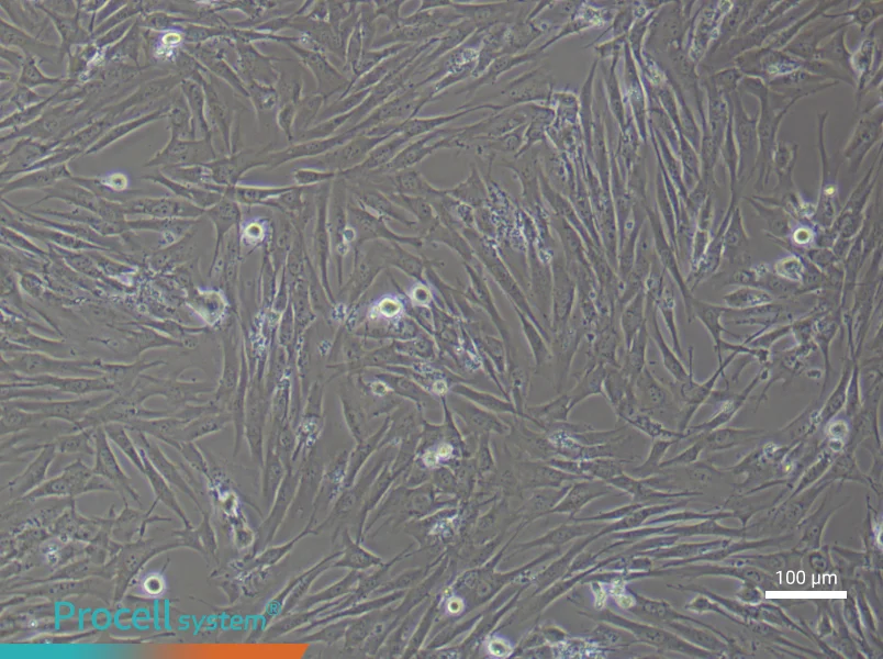 Human Pulmonary Artery Smooth Muscle (Primary cell immortalization) Cell Complete MediumHuman Pulmonary Artery Smooth Muscle (Primary cell immortalization) Cell Complete Medium - 3