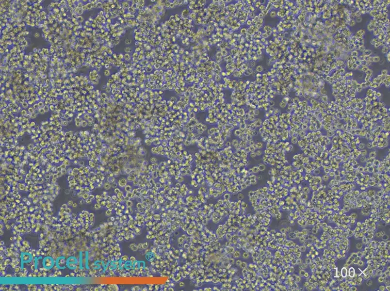 HuT 78 Cell Complete Medium - 3