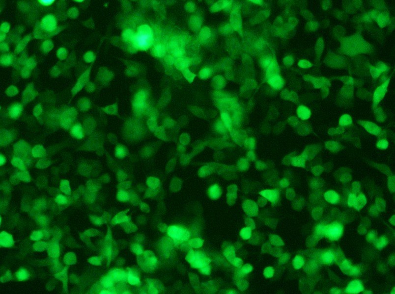 RM-1-GFP Cell Complete Medium - small - 10
