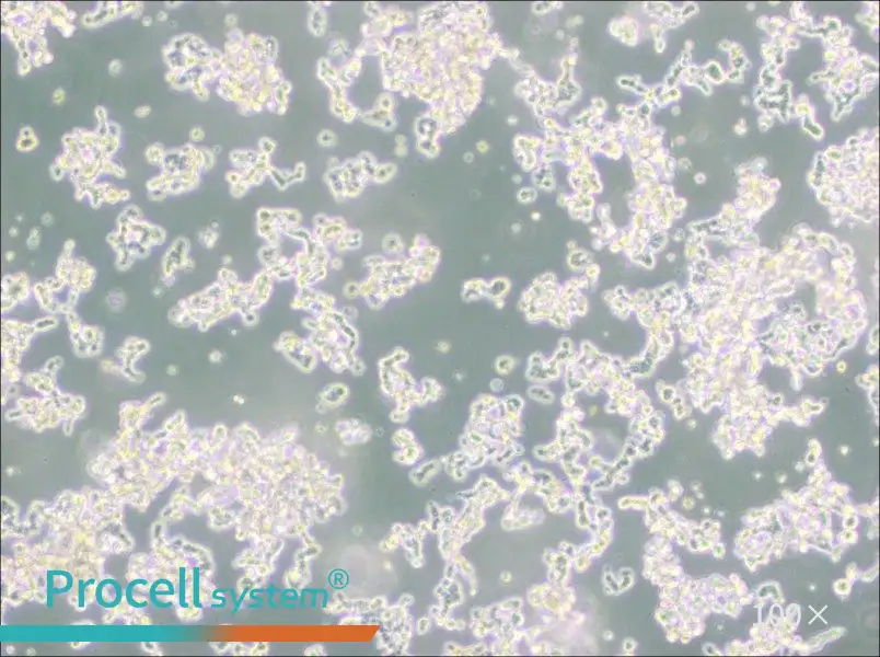 WERI-Rb-1 Cell Complete Medium - 1