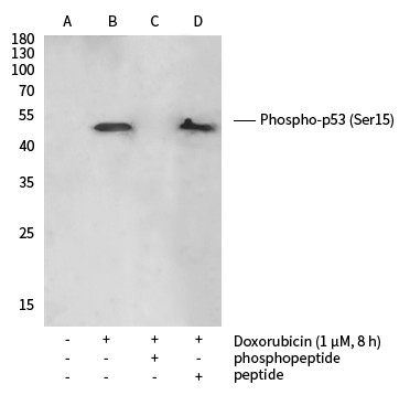 Recombinant Phospho-p53 (Ser15) Monoclonal Antibody-searchlist-1