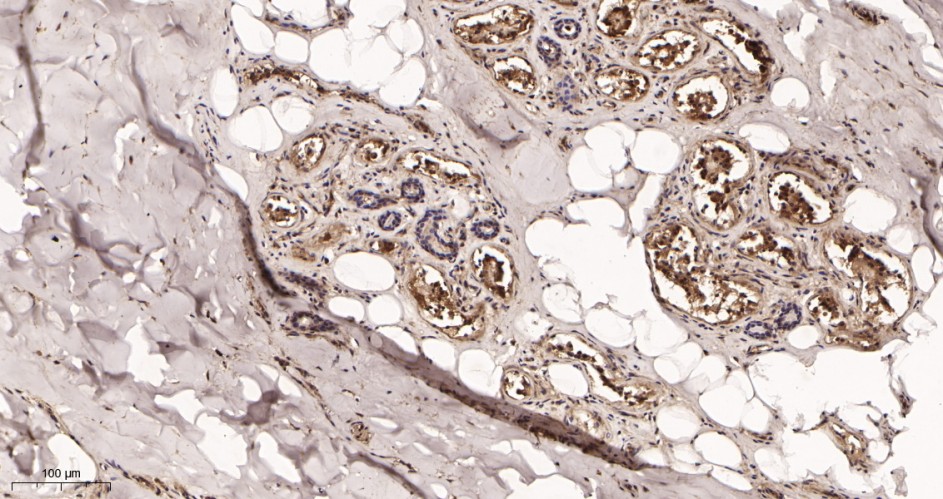 Recombinant Collagen III Monoclonal Antibody - small - 2