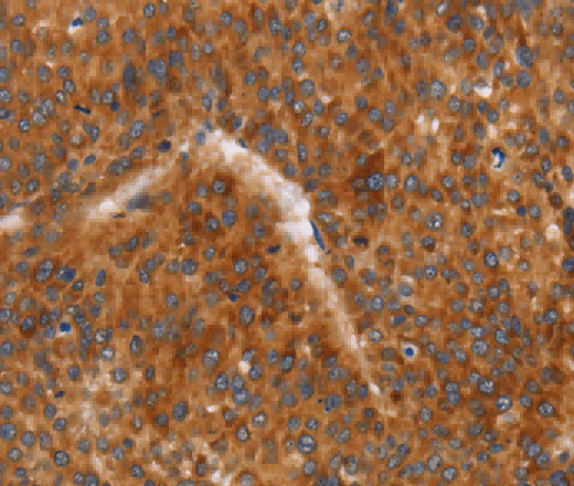 CD38 Polyclonal Antibody - 2