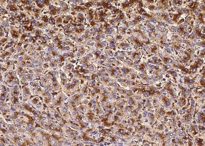 LAMP2/CD107b Monoclonal Antibody - 2