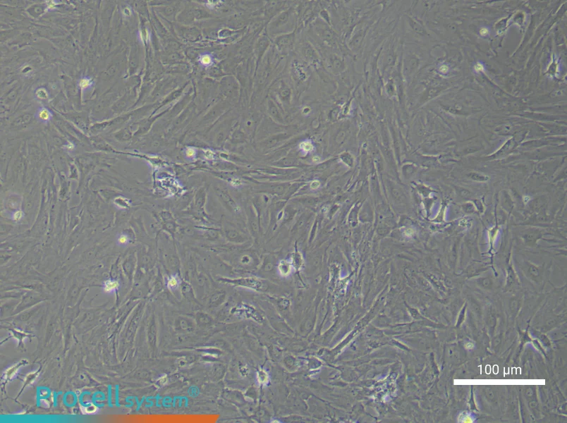 Rat Retinal Muller Cell Complete Medium - 2