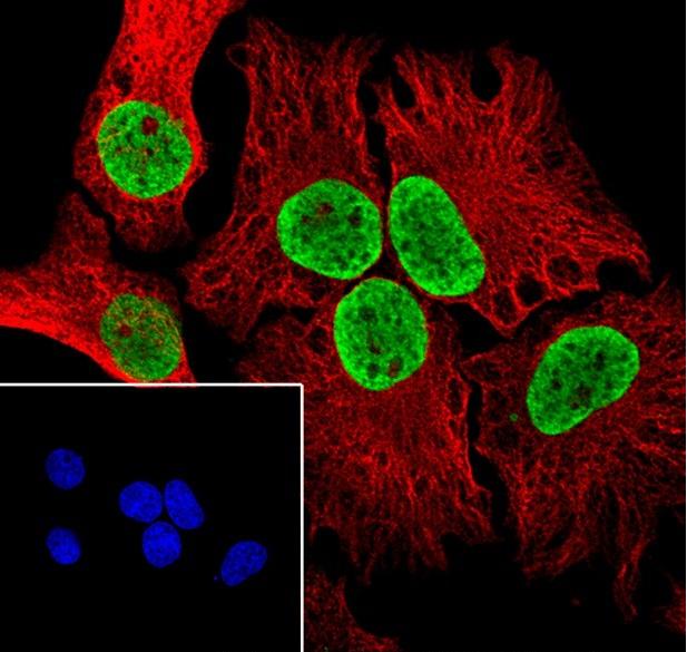 Recombinant Histone H3 (Di Methyl Lys122) Monoclonal Antibody-searchlist-1