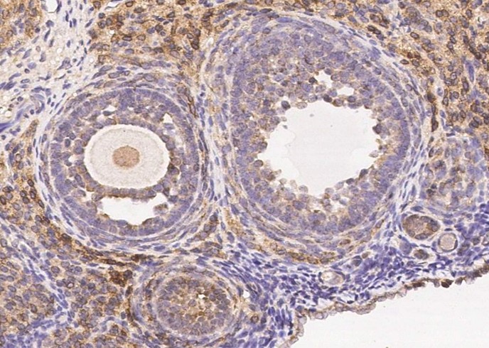 Recombinant HE4/WFDC2/WAP5 Monoclonal Antibody - small - 2