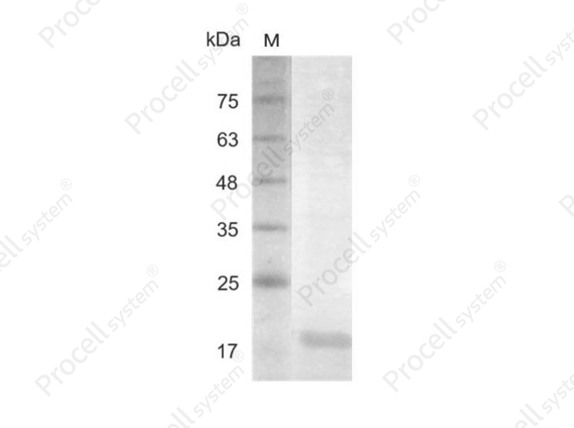 IL-23 p19/IL-23/IL-23A/SGRF, Human, Recombinant