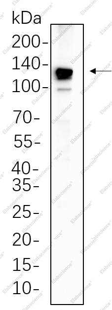 Recombinant PYK2 Monoclonal Antibody - 1