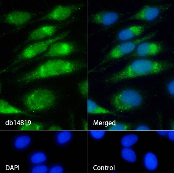 Recombinant P4HB Monoclonal Antibody - 2