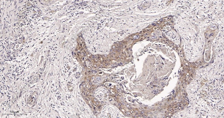 Recombinant RIP Monoclonal Antibody - 3
