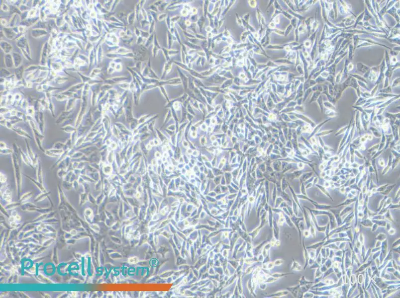 SK-UT-1 Cell Complete Medium - 1
