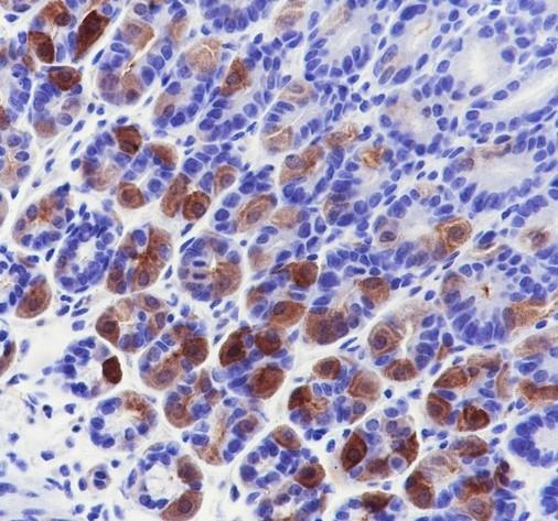 Recombinant Creatine kinase B type Monoclonal Antibody - 3