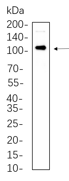 Recombinant Androgen Receptor Monoclonal Antibody-searchlist-1