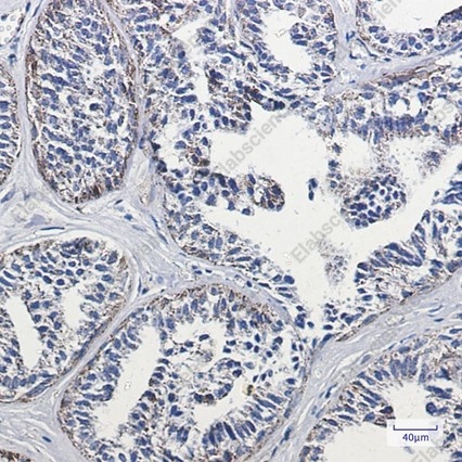 Recombinant Lipoamide Dehydrogenase Monoclonal Antibody - 3