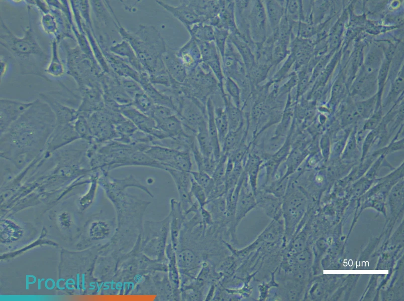 Mouse Cerebral Artery Smooth Muscle Cell Complete Medium - 6