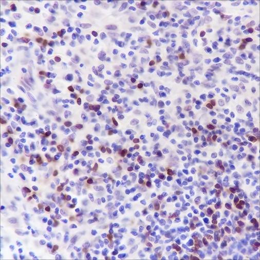 Recombinant BOB-1 Monoclonal Antibody - 2