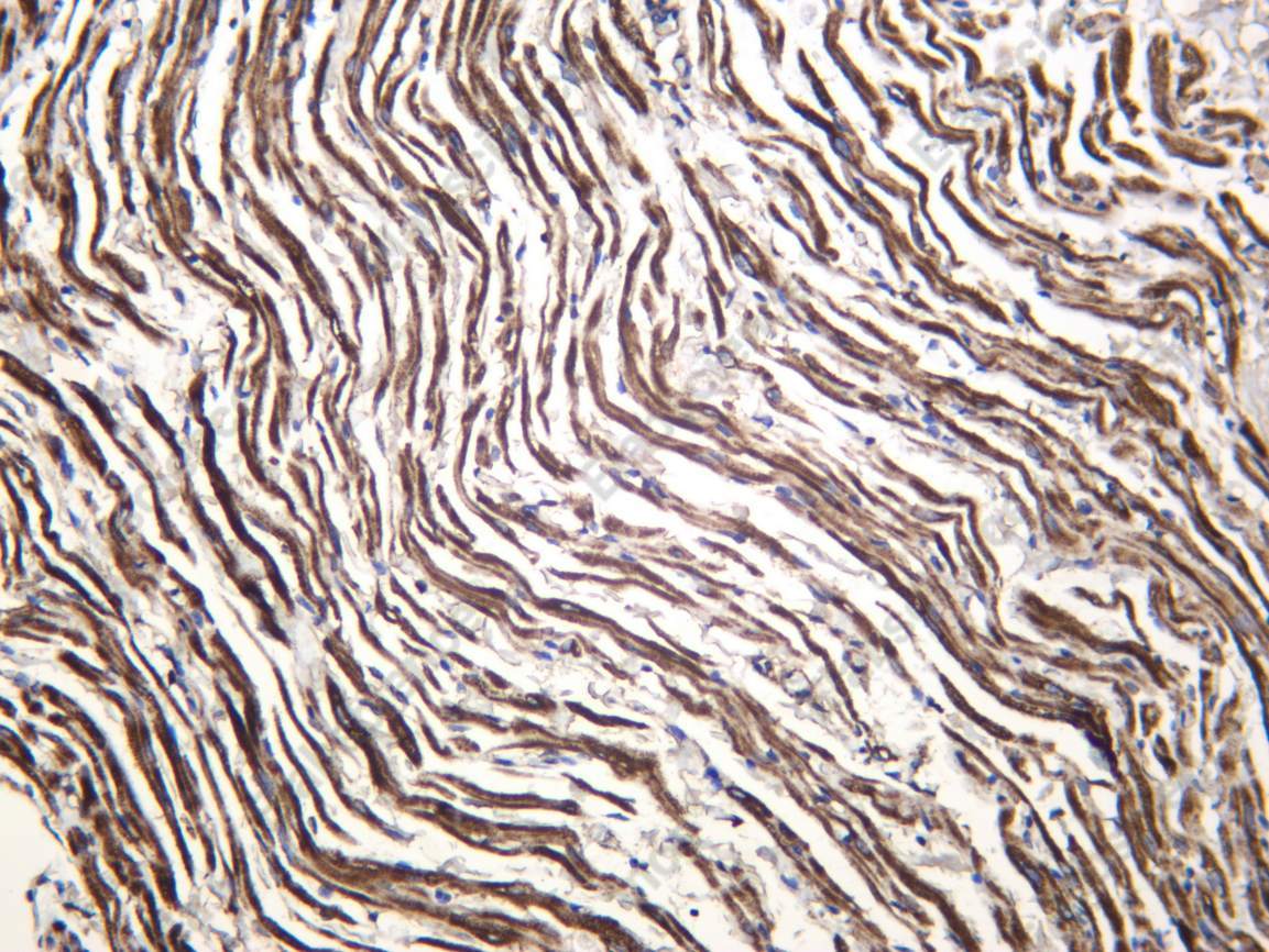 Recombinant AATC Monoclonal Antibody - 4