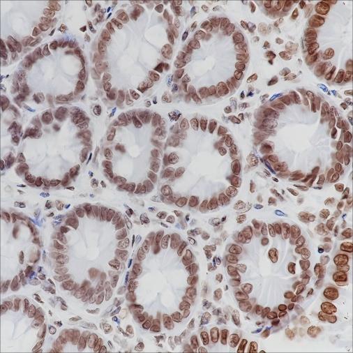 Recombinant ERCC1 Monoclonal Antibody - 2