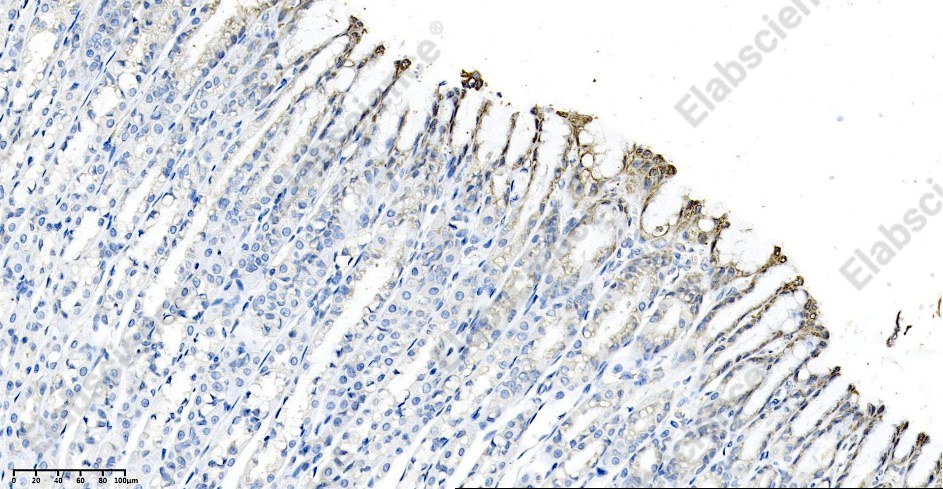 Recombinant Calreticulin Monoclonal Antibody - 3