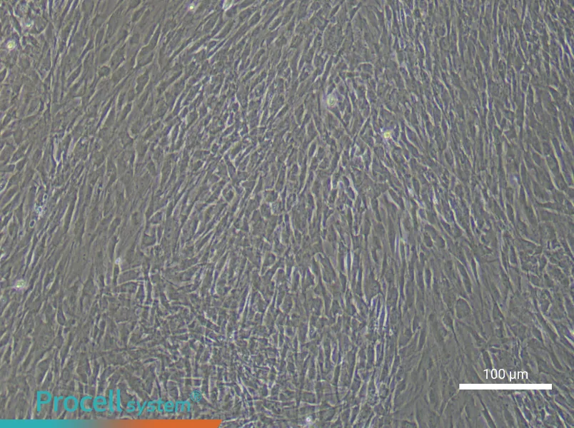 Human Uterine Smooth Muscle Cell Complete Medium - 2