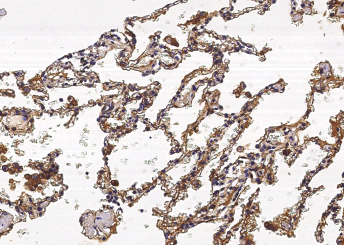 S100A10 Monoclonal Antibody - small - 4