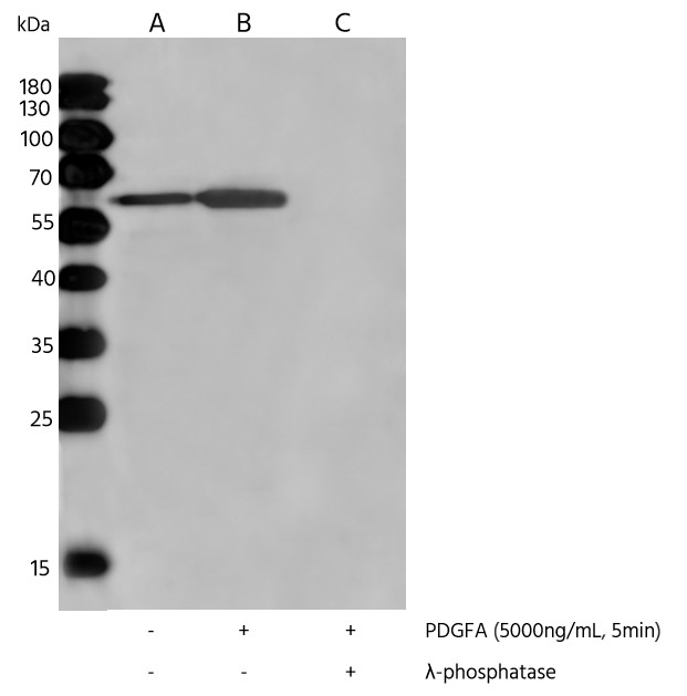 Recombinant Phospho-AKT (Ser473) Monoclonal Antibody - small - 7
