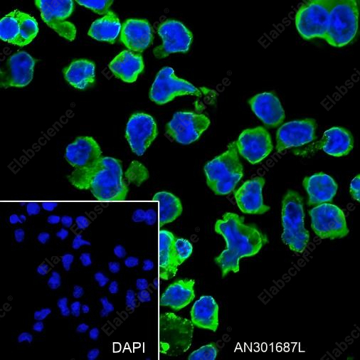 Recombinant VPAC1 Monoclonal Antibody - 4
