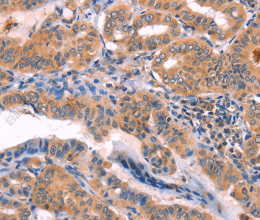 NCEH1 Polyclonal Antibody - 2