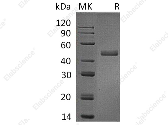 Recombinant Human IL17B/IL-17B Protein (Fc Tag) - 1