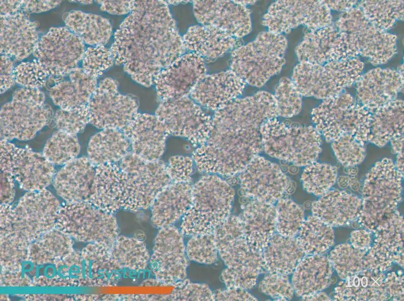 HuT 102 Cell Complete MediumHuT 102 Cell Complete Medium - 3