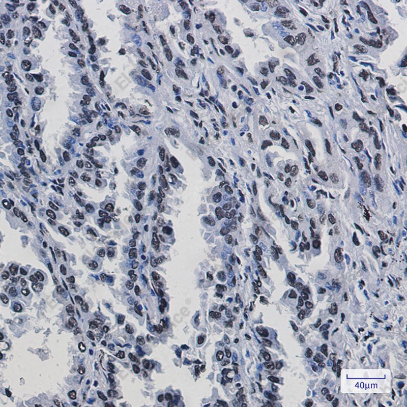 Recombinant KAP1 Monoclonal Antibody - 3