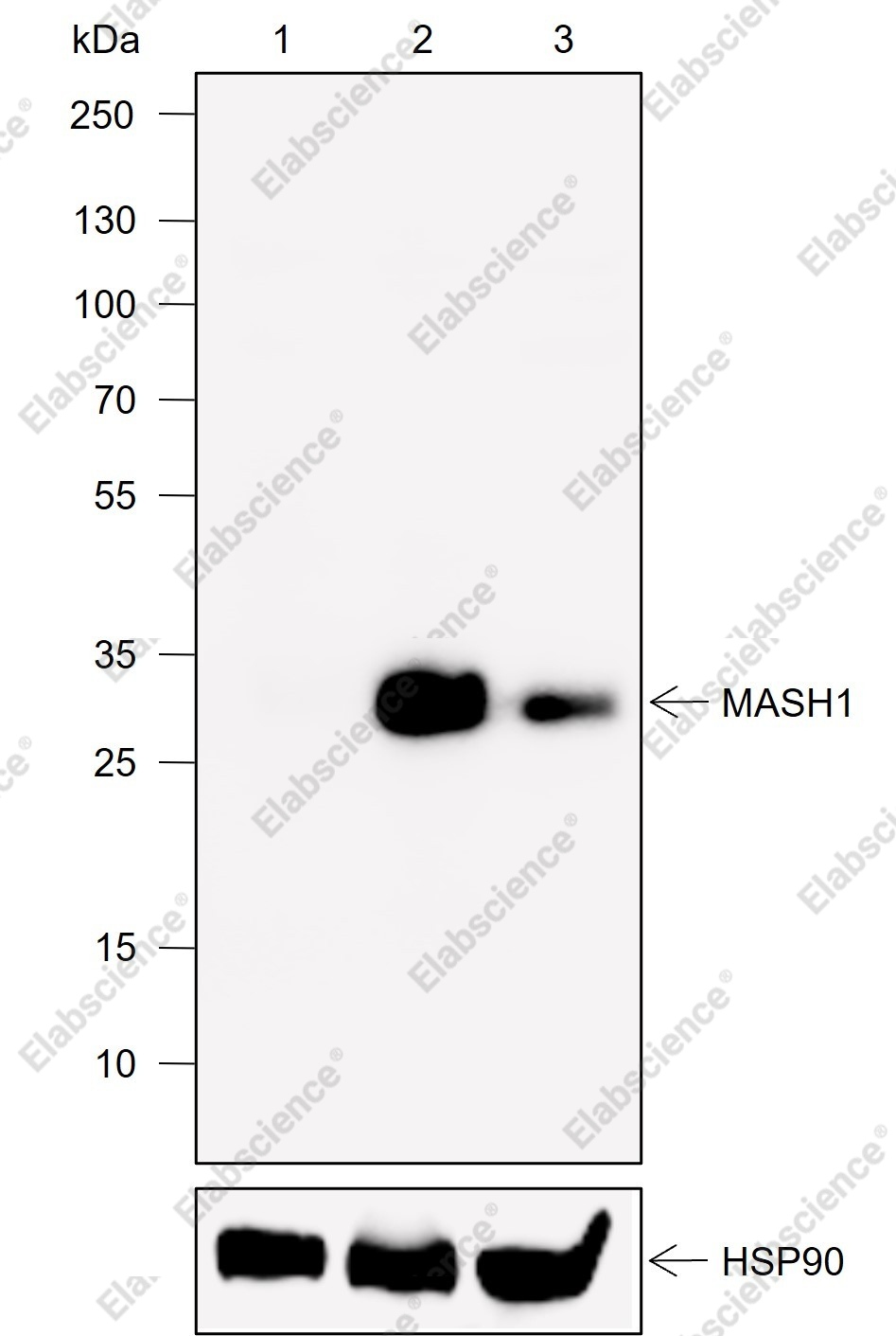 Recombinant MASH1 Monoclonal Antibody - 1